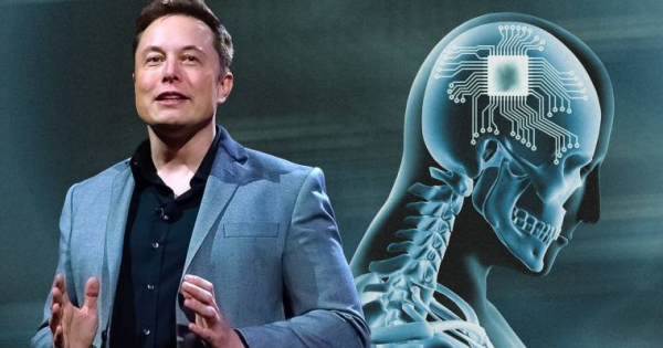 Elon Musk agyba ültethető chipje az emlékeinket is lementheti